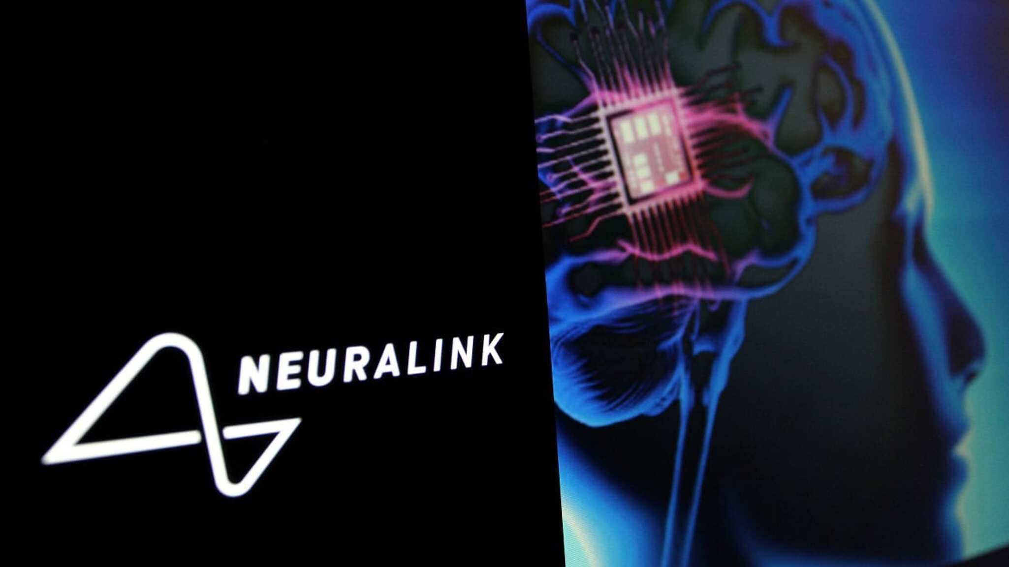 neuralink,-de-musk,-esta-de-olho-nos-robos-humanoides;-entenda